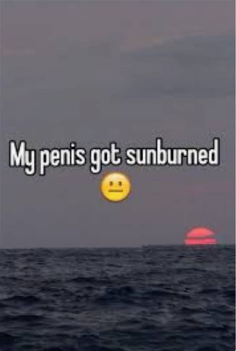 sunburned genitals.